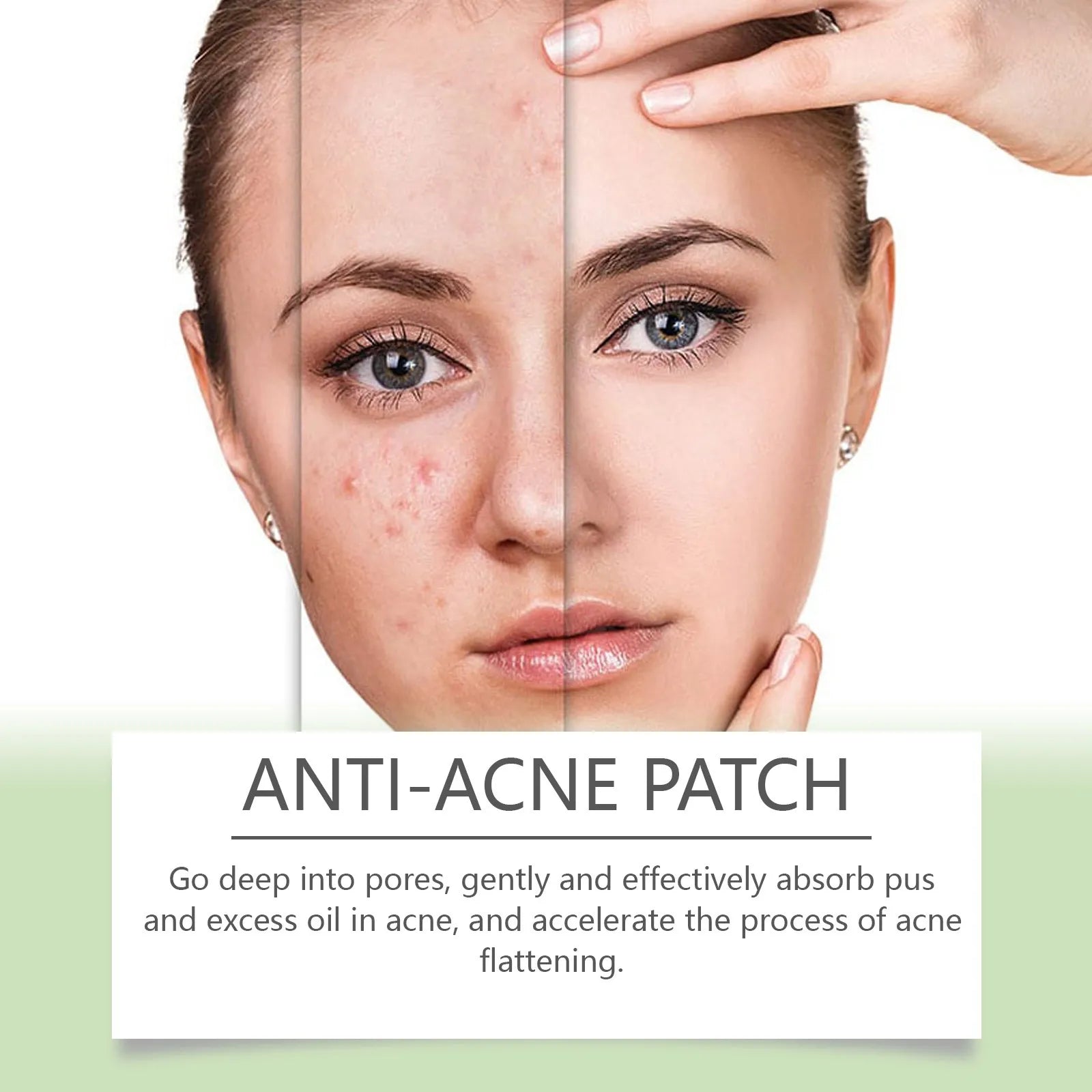 Acne Patch for Blemish Care