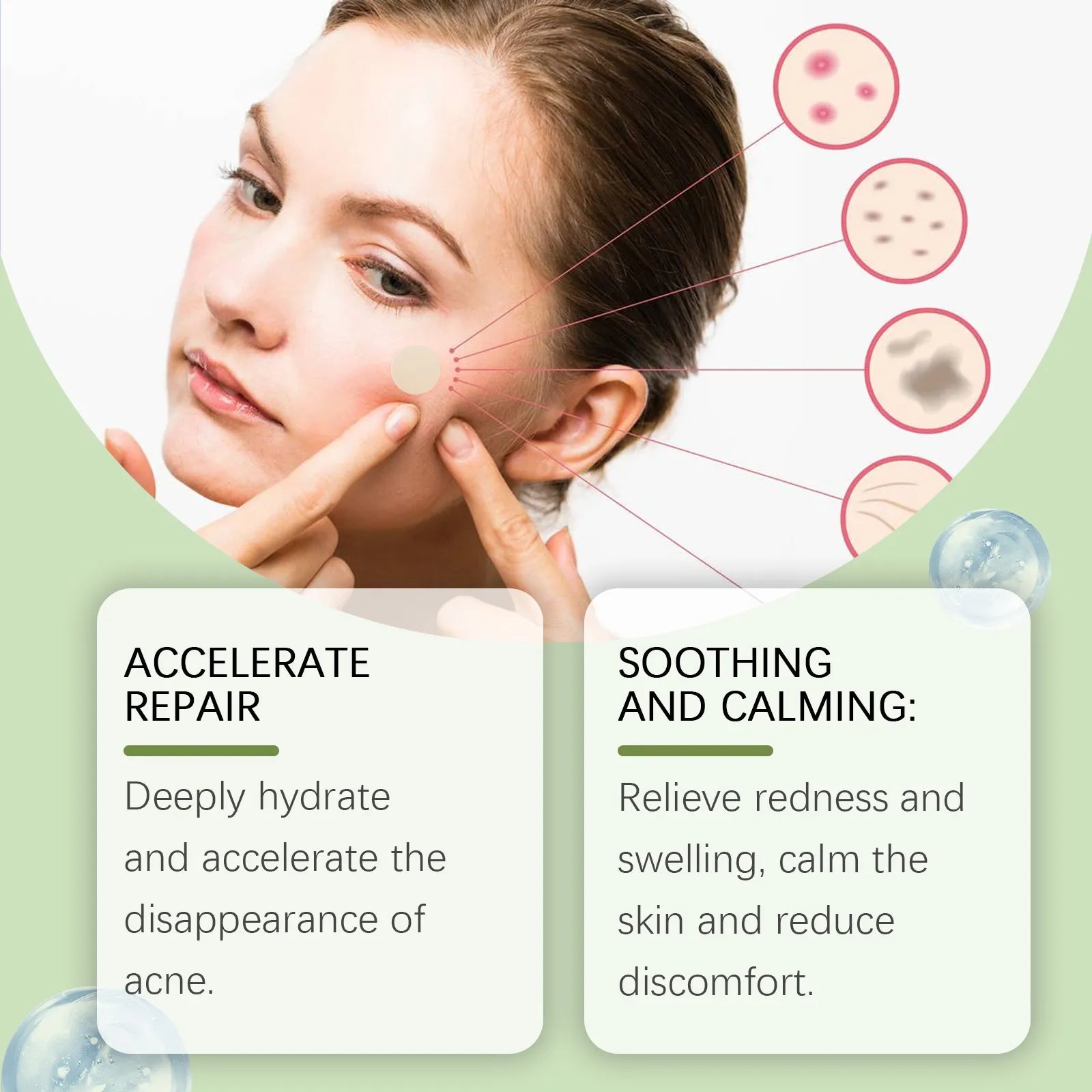 Acne Patch for Blemish Care