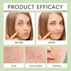 Acne Patch for Blemish Care